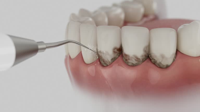 Trusted Teeth Cleaning And Checkup service in Baldwyn, MS - Dentist Open Now